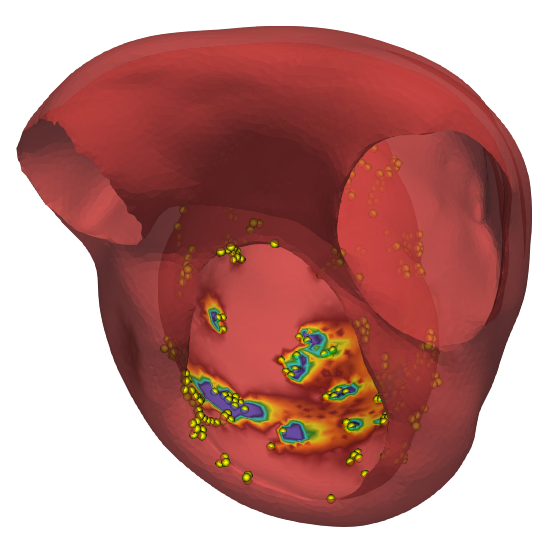 Reconstructed scar solution from measured electrocardiography data